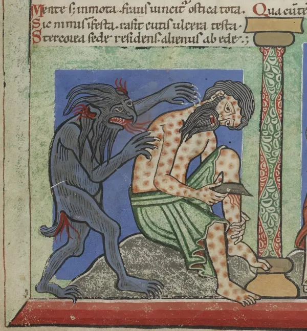 Pre-European Leprosy  in the Americas